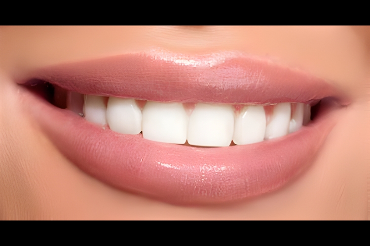 Can I fix my really bad teeth?