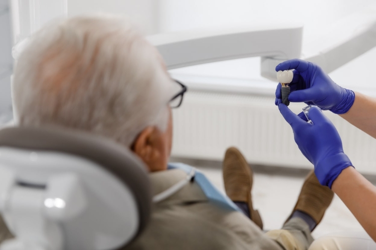 Everything You Need to Know About Dental Implants