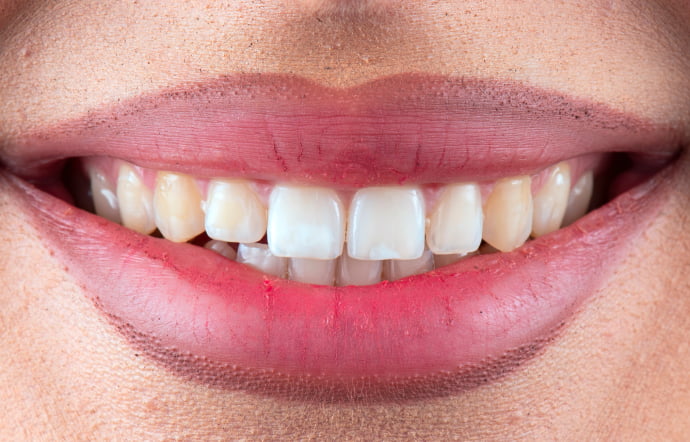 Before -Church Lane Dental