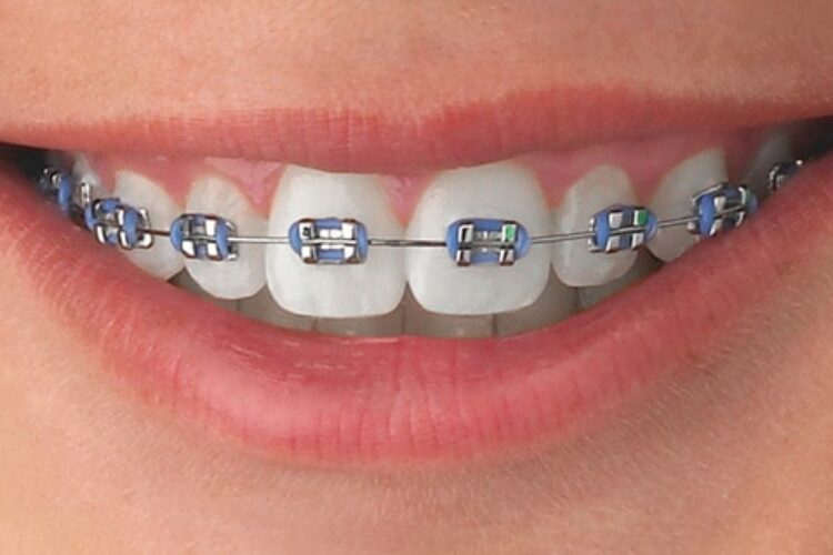 Blog - Church Lane Dental